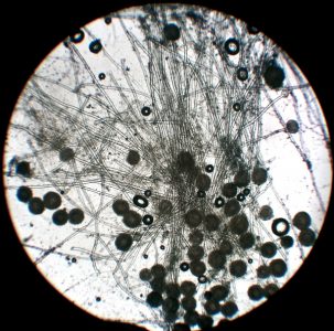 即時(shí)快速檢測(cè)儲(chǔ)存產(chǎn)品是否帶有霉菌感染風(fēng)險(xiǎn)